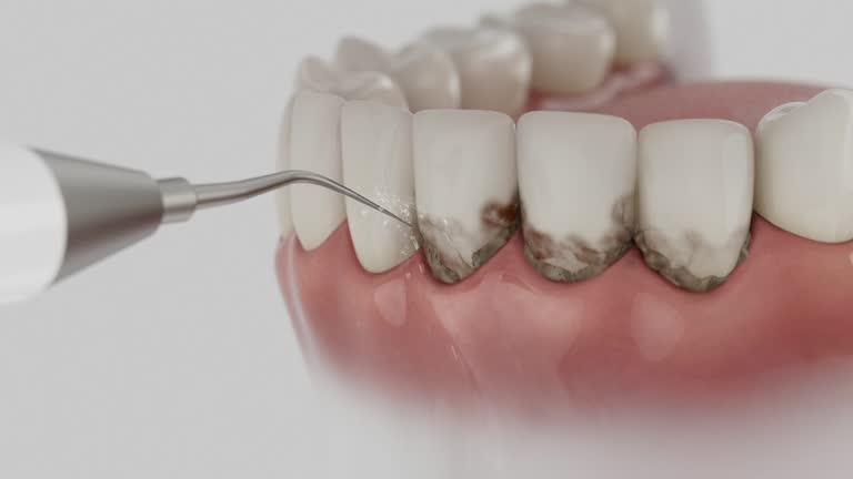 Trusted Tooth Extraction service in Bolivar Peninsula, TX - Dentist Open Now